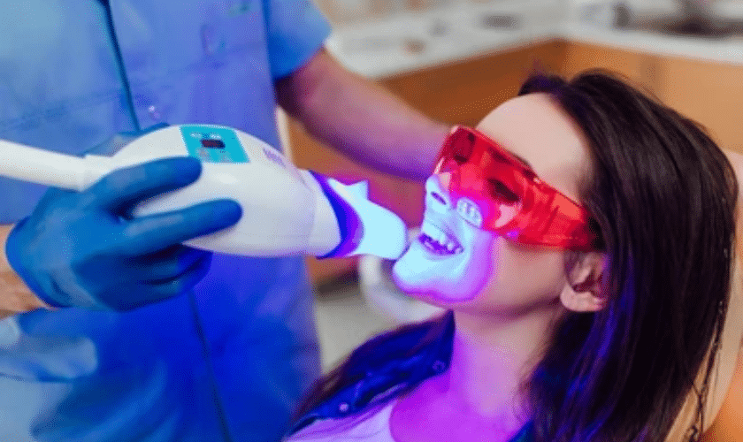 Laser Teeth Whitening